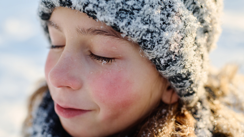 Cuidado de la piel en invierno