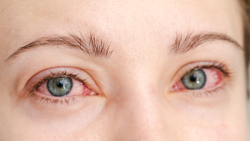 Pros y contras de los sueros para pestañas