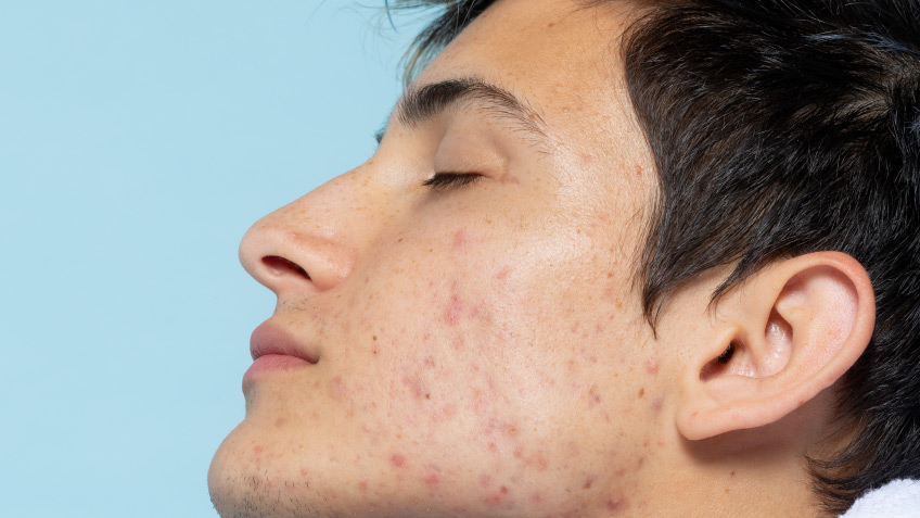 Cepillos faciales eléctricos: ¿son recomendables?