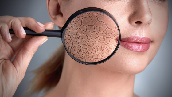 Cómo hidratar tu piel antes del maquillaje, para pieles deshidratadas | Piel  Saludable
