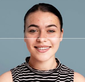 Resorcinol: qué es y para qué sirve