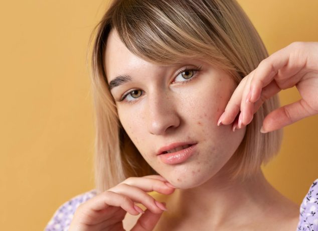 Procedimientos dermatológicos para tratar cicatrices de acné