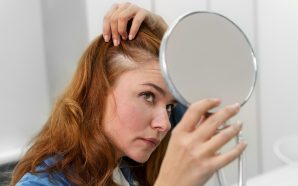 ¿Qué es la dermatitis seborreica?