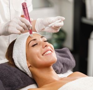 ¿Qué es el microneedling y para qué sirve?