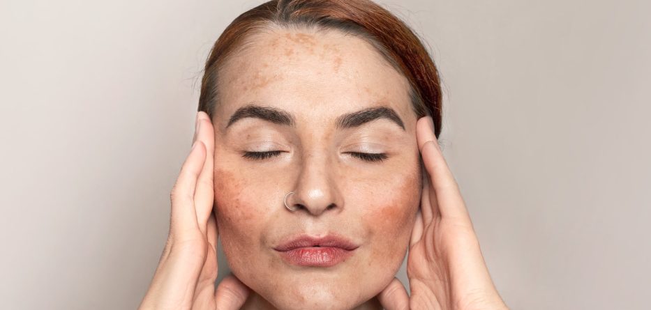 Ácido tranexámico: la nueva era despigmentante